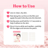 CATCH ME PATCH Her’s Band Big Volume Spot – Hydrocolloid Spot Cover Patches, Ultra-Thin & Water-Resistant Design, 126 Count